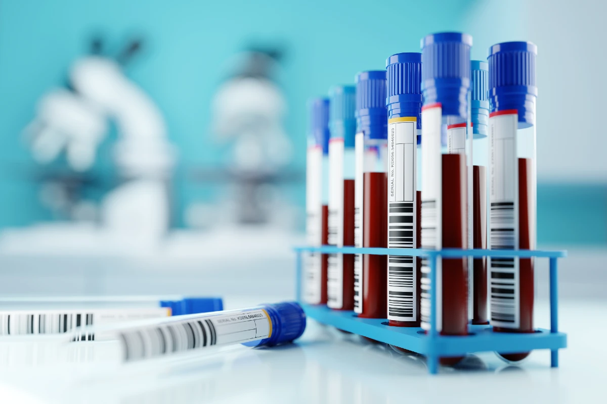 image depicting blood samples